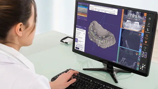 Full Arch Same-Day Surgery Temp Design