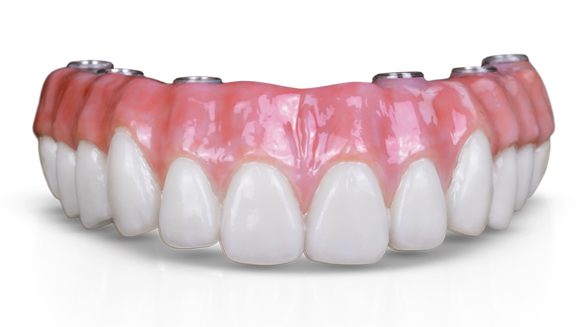 Implant Full Arch Hybrid Zirconia