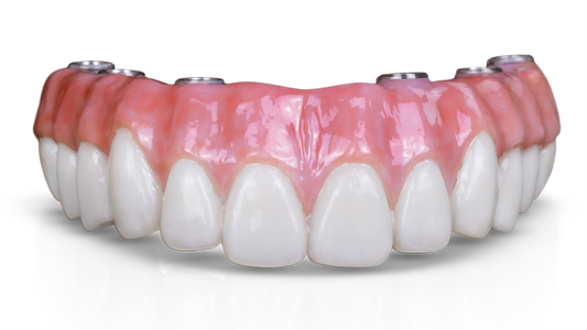 Implant Full Arch Hybrid Zirconia